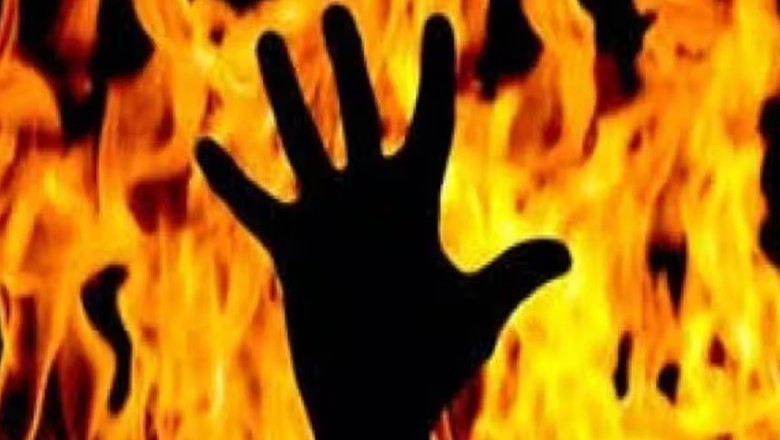 Sialkot woman sets husband on fire over suspicion of second marriage