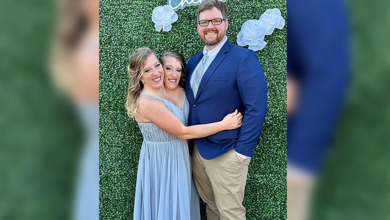 Famous conjoined twin Abby gets married to US army officer