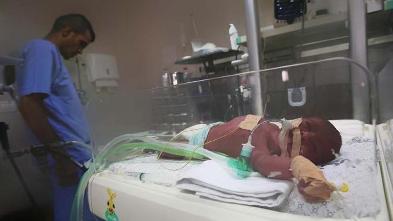 Sindh has lowest mortality rate among critically ill children: study