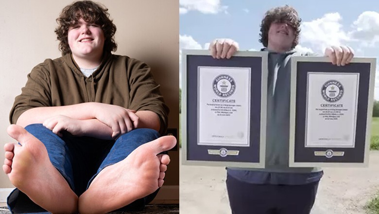 US teen sets Guinness world records for largest feet and hands