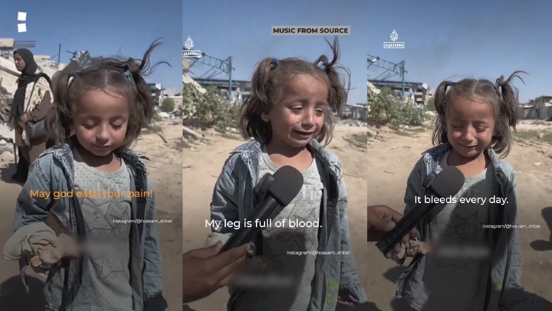 “My leg is full of blood,” says teary-eyed Palestinian girl fleeing north Gaza amid Israeli attacks