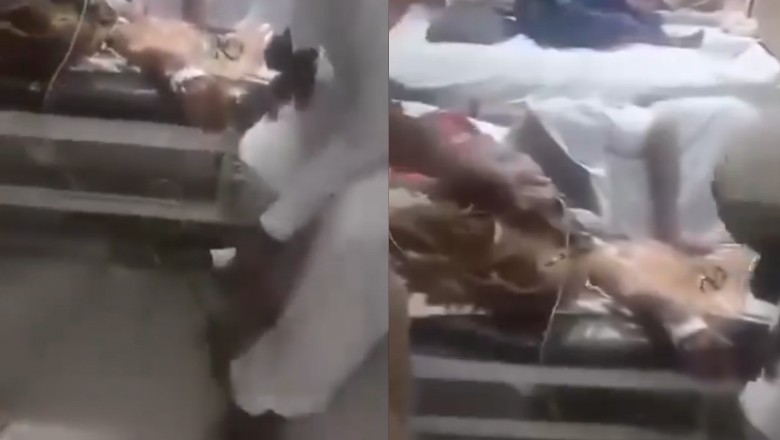 Video shows bicycle pump being used to deliver oxygen to patient at Umerkot hospital