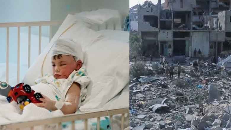 “He hasn’t spoken for 2 weeks,” Lebanon child loses limbs, his entire family in Israeli strike