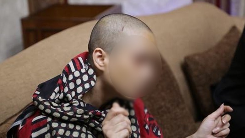 Karachi woman's head shaved by family for love marriage desire