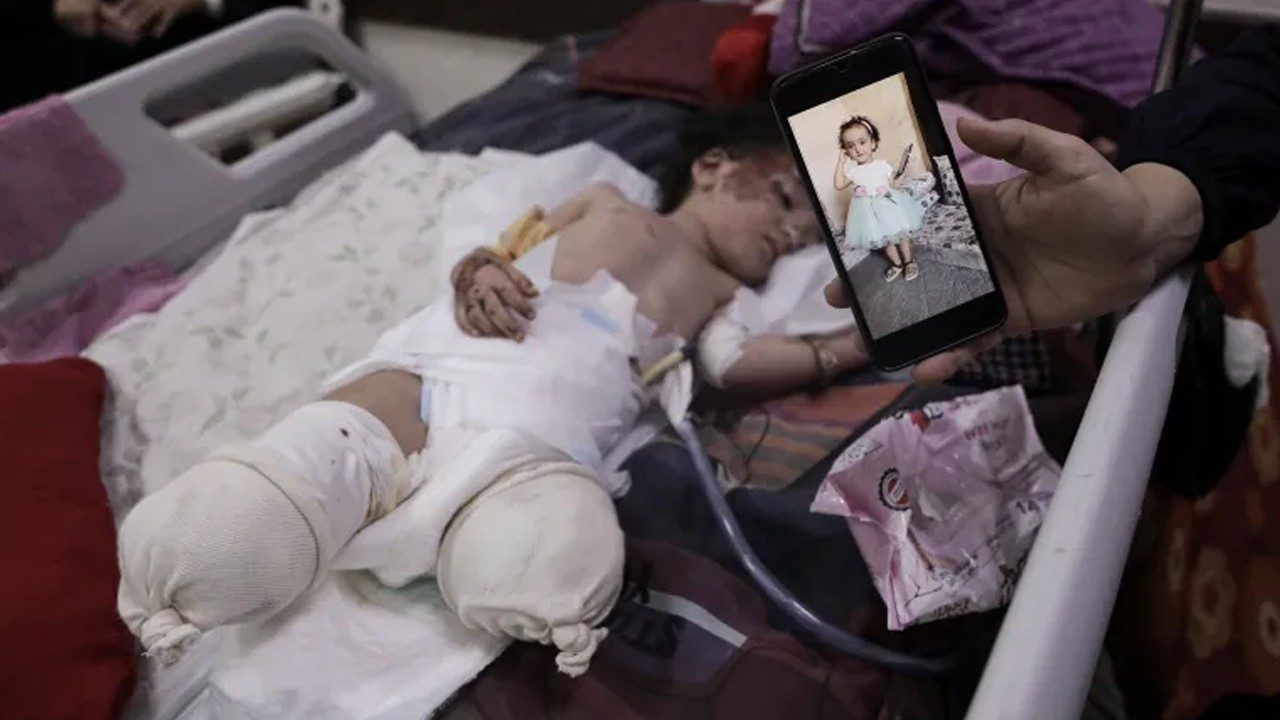 3-year-old girl, recently given anti-polio drops, loses legs in Israeli airstrike