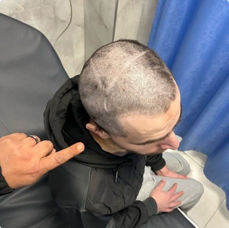 Israeli forces carve Star of David on freed Palestinian prisoner’s head