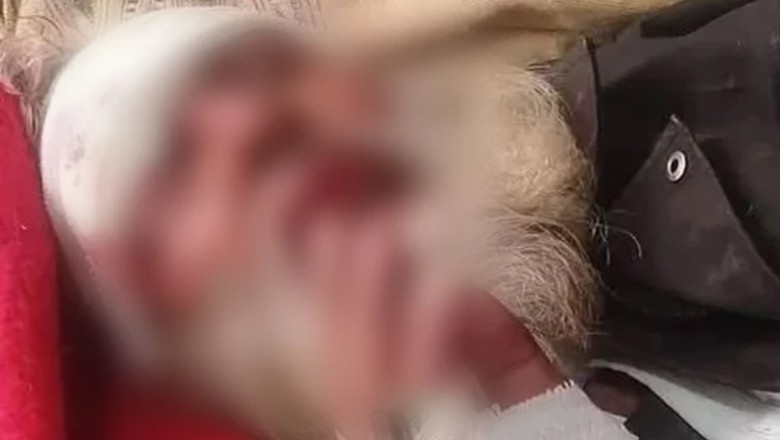 Elderly man brutally tortured in Bahawalpur, abuse shown live to son abroad