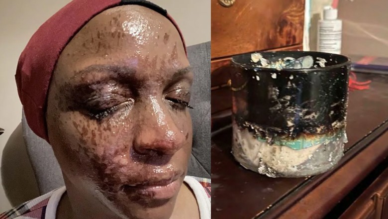 US woman files lawsuit after Bath &amp; Body Works candle explodes in her face
