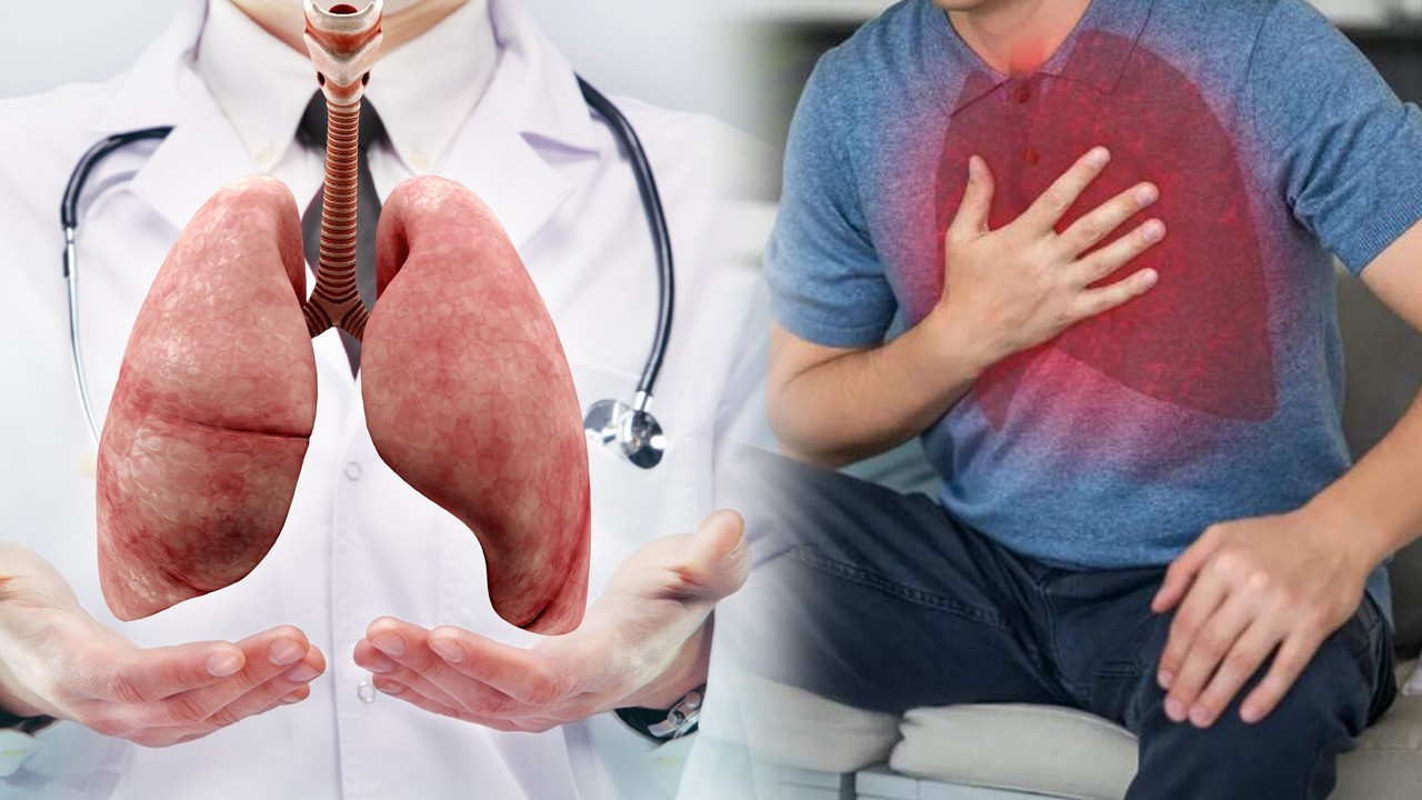 Karachi’s humid weather triggers 30% spike in respiratory illnesses, warn doctors