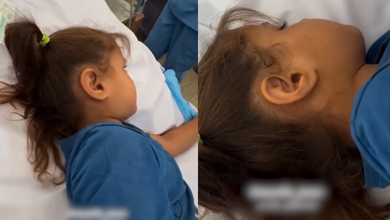 Palestinian girl miraculously survives headshot by Israeli drone in Gaza