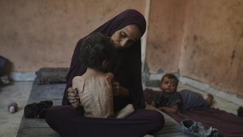 Musk's Grok slammed for false claim about photo of malnourished Gaza girl