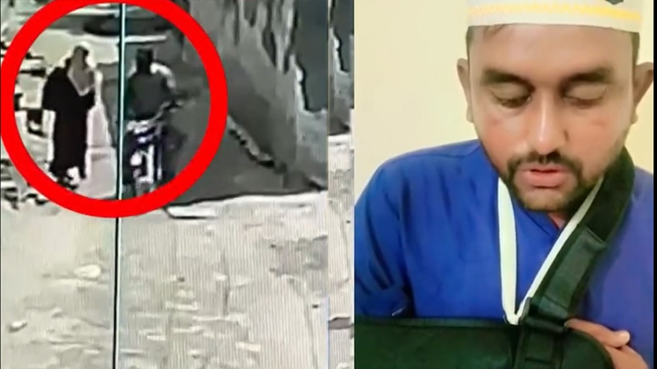 Man who used to harass women falls from motorbike, suffers fracture