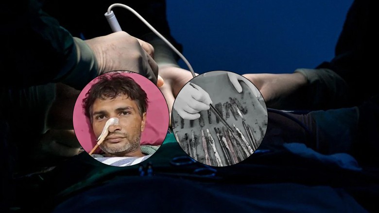 Indian man swallows 29 spoons, 19 toothbrushes, 2 pens at rehab