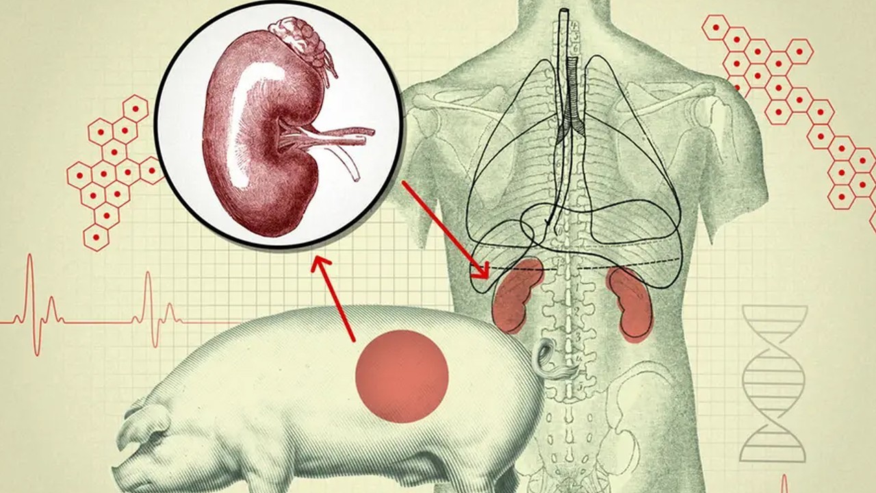 Scientists create human kidney-like mini organs using pig kidneys